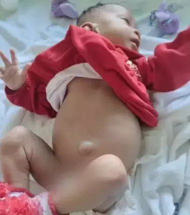 Pequena Ísis já precisou passar por diversas internações e um dos rins da menina foi retirado – Foto: Arquivo Pessoal: /Reprodução/ND