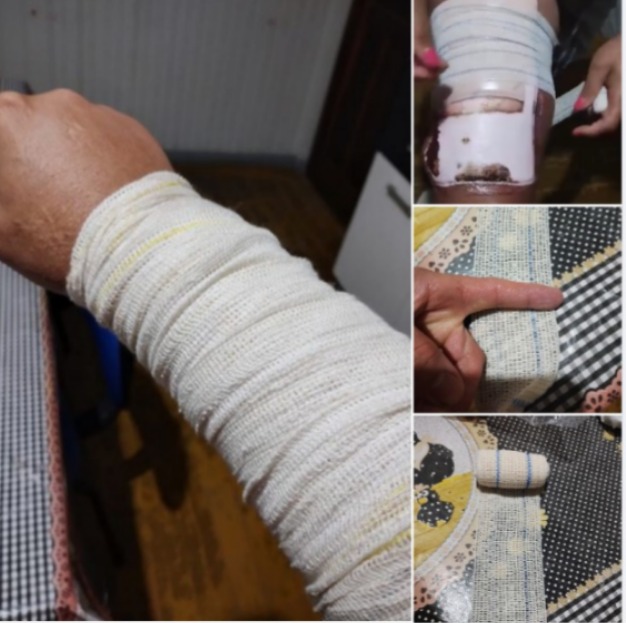 Fotos da cirurgia